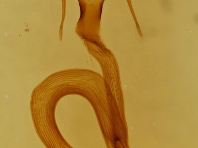 genitalia view of adult Mythimna opada