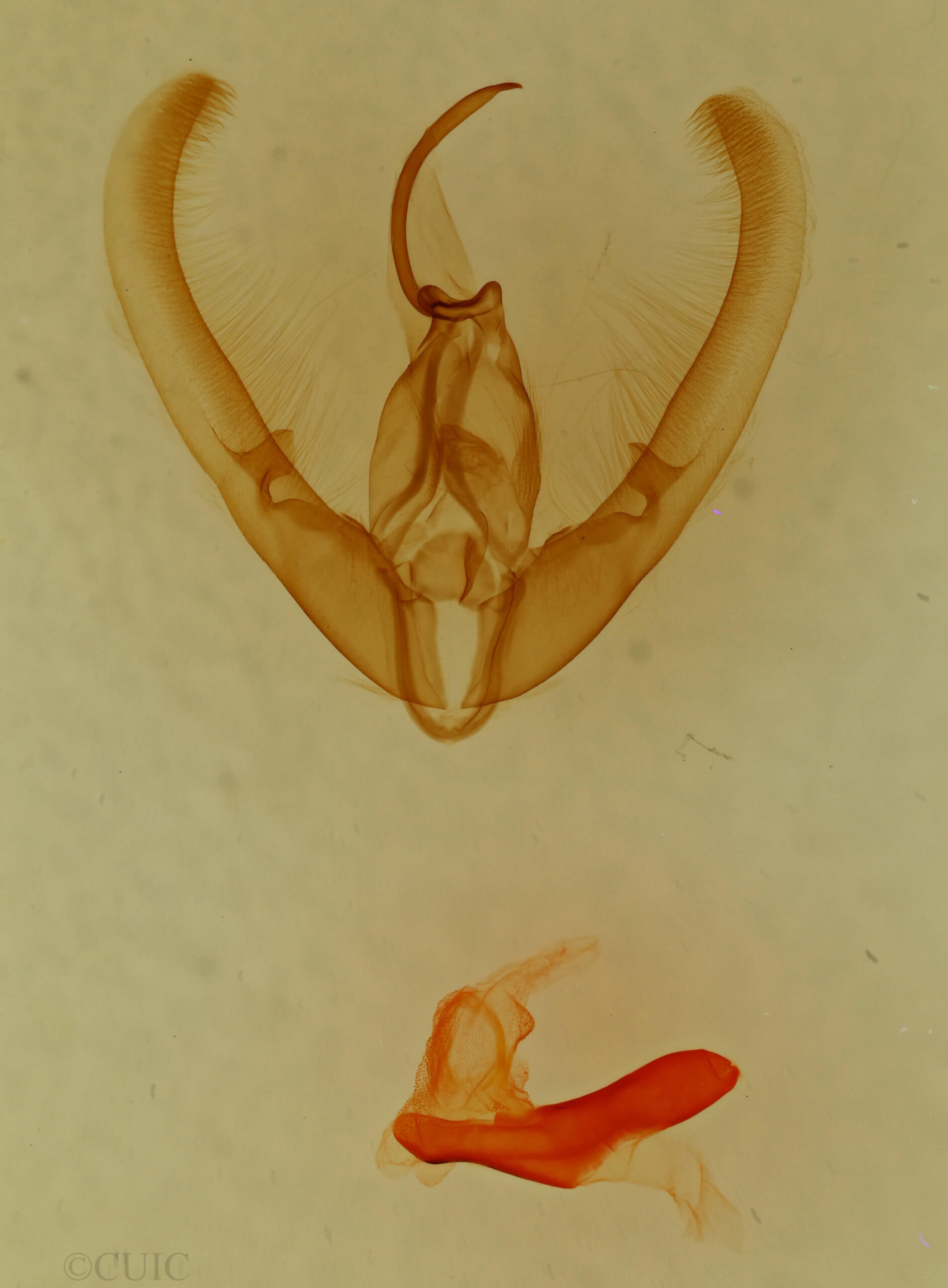 genitalia view of adult Elaphria villicosta