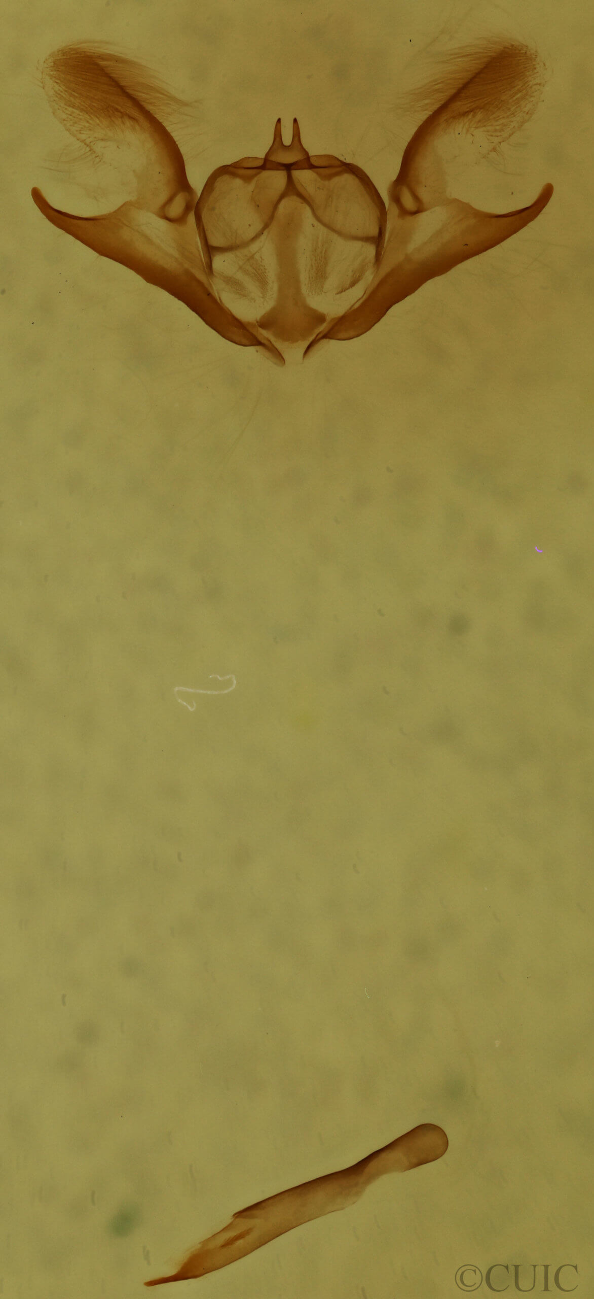 genitalia view of adult Iridopsis ephyraria