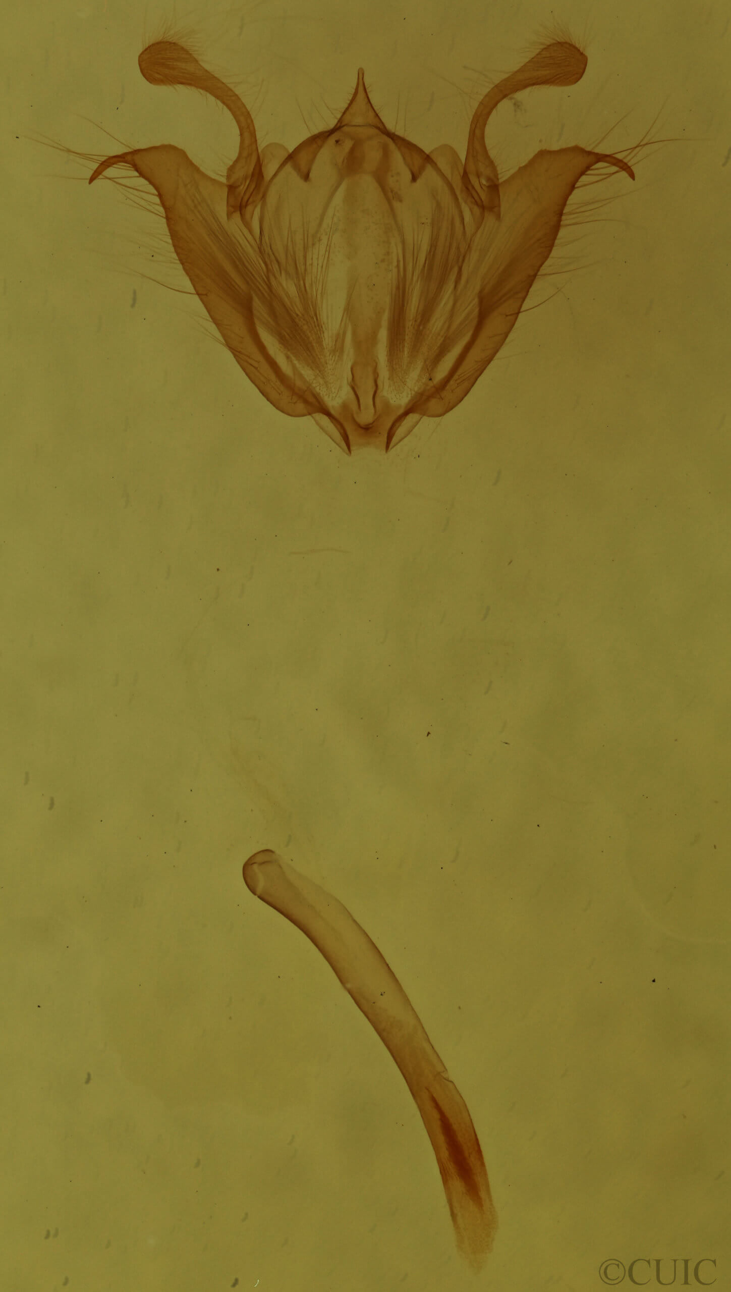 genitalia view of adult Iridopsis larvaria