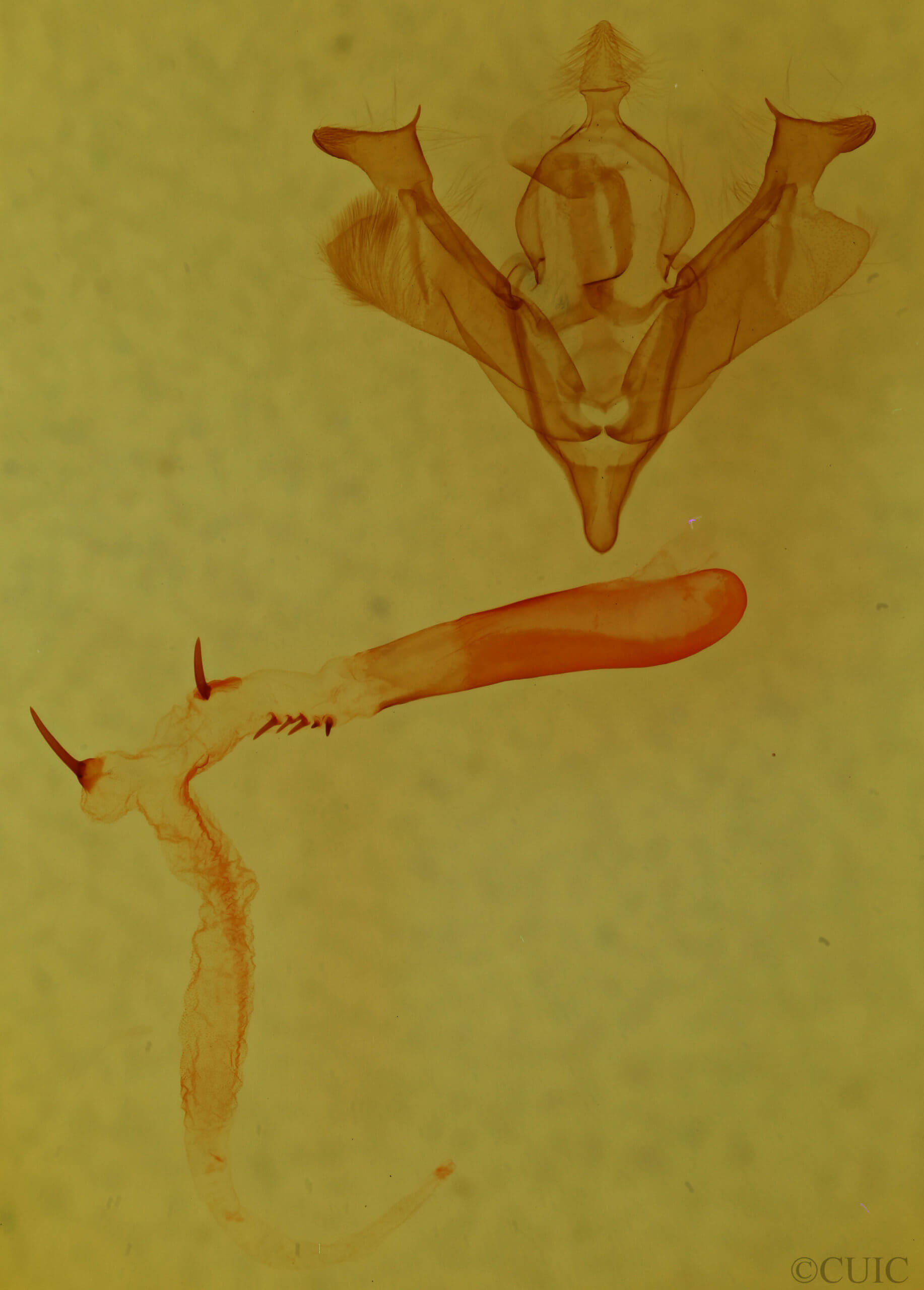 genitalia view of adult Anhimella perbrunnea