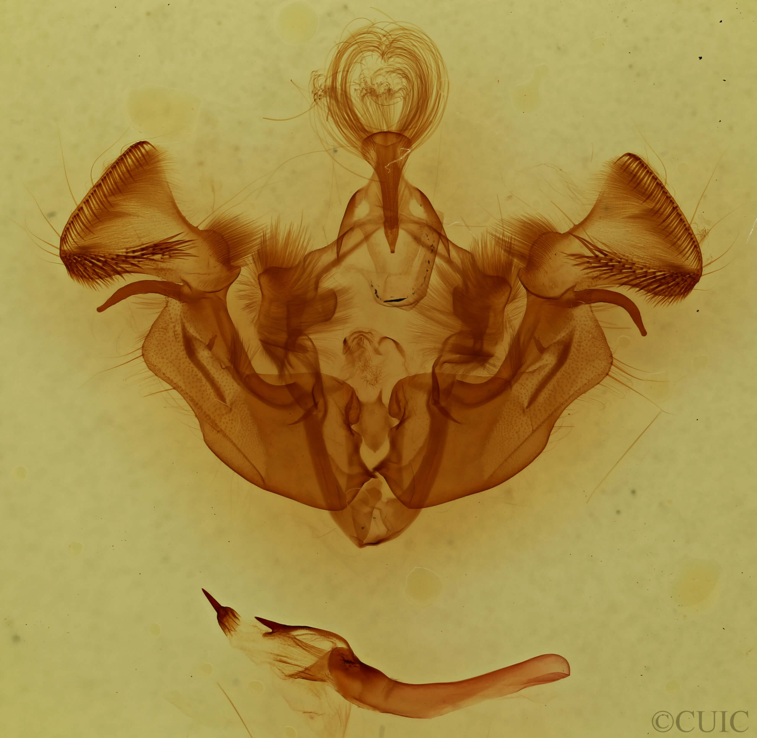 genitalia view of adult Apamea nigrior