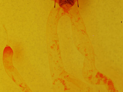 genitalia view of adult Arbostola