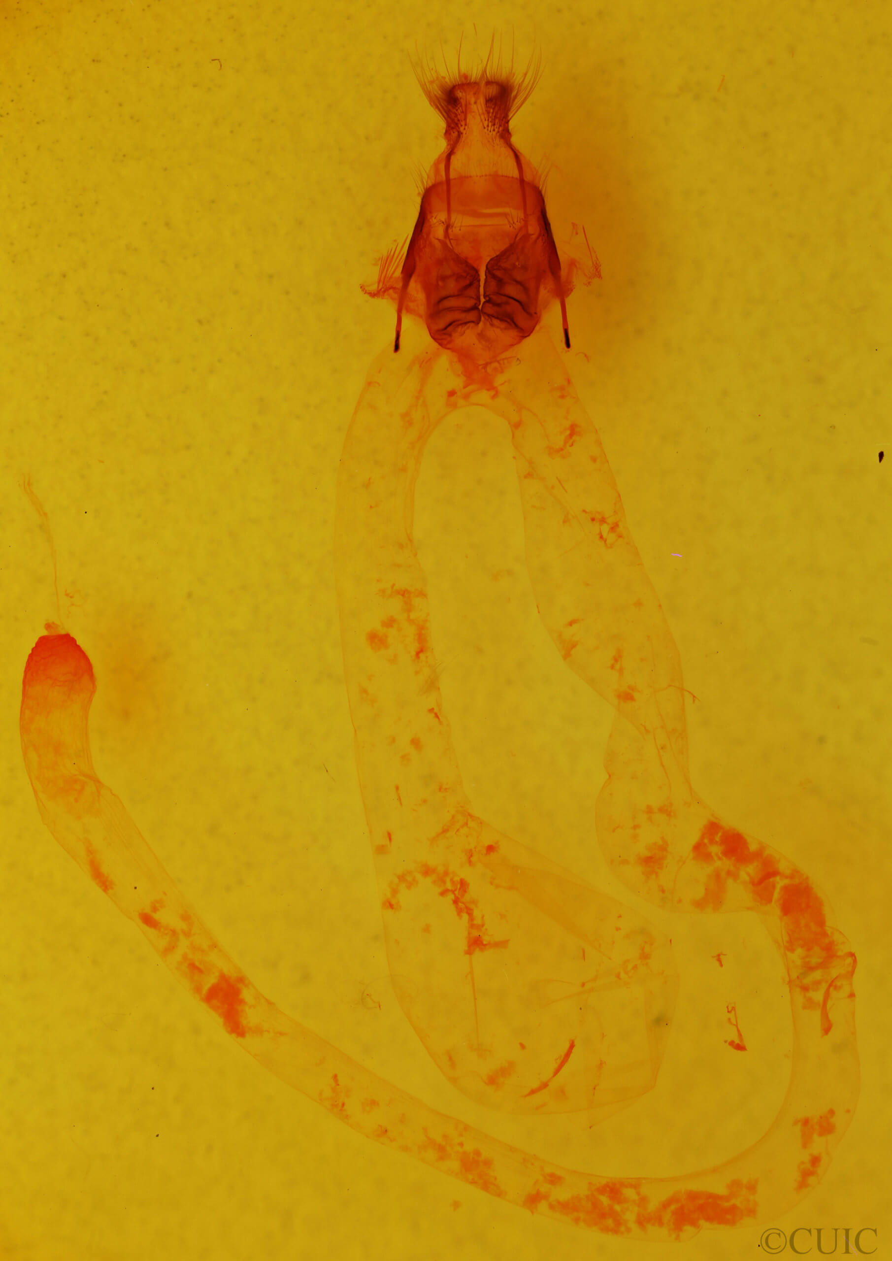 genitalia view of adult Arbostola