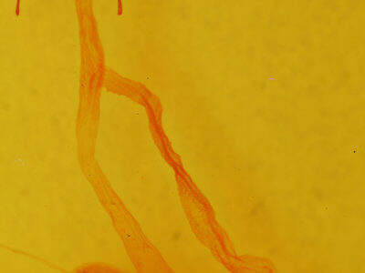 genitalia view of adult Hemicephalis proserpina
