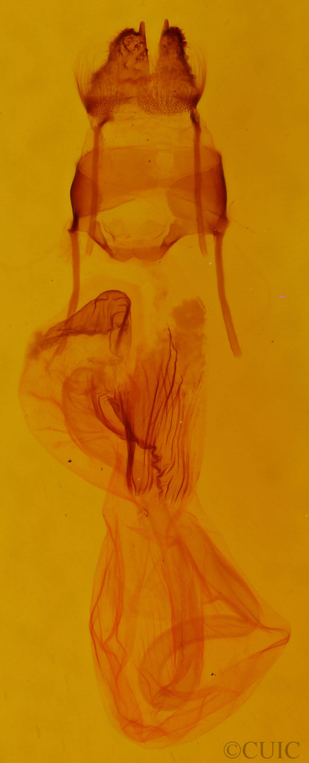 genitalia view of adult Aseptis serrula