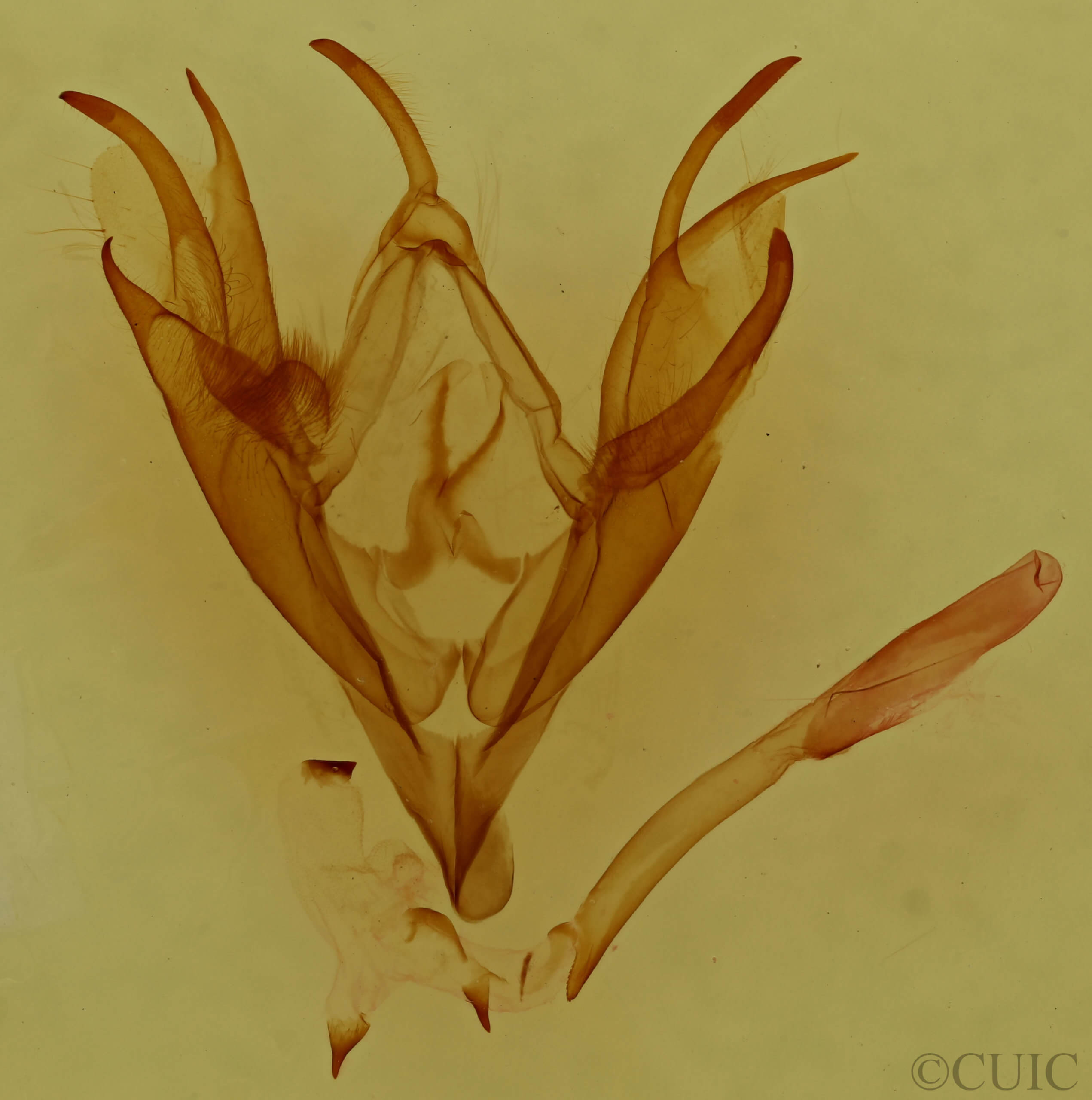 genitalia view of adult Caenurgina erechtea