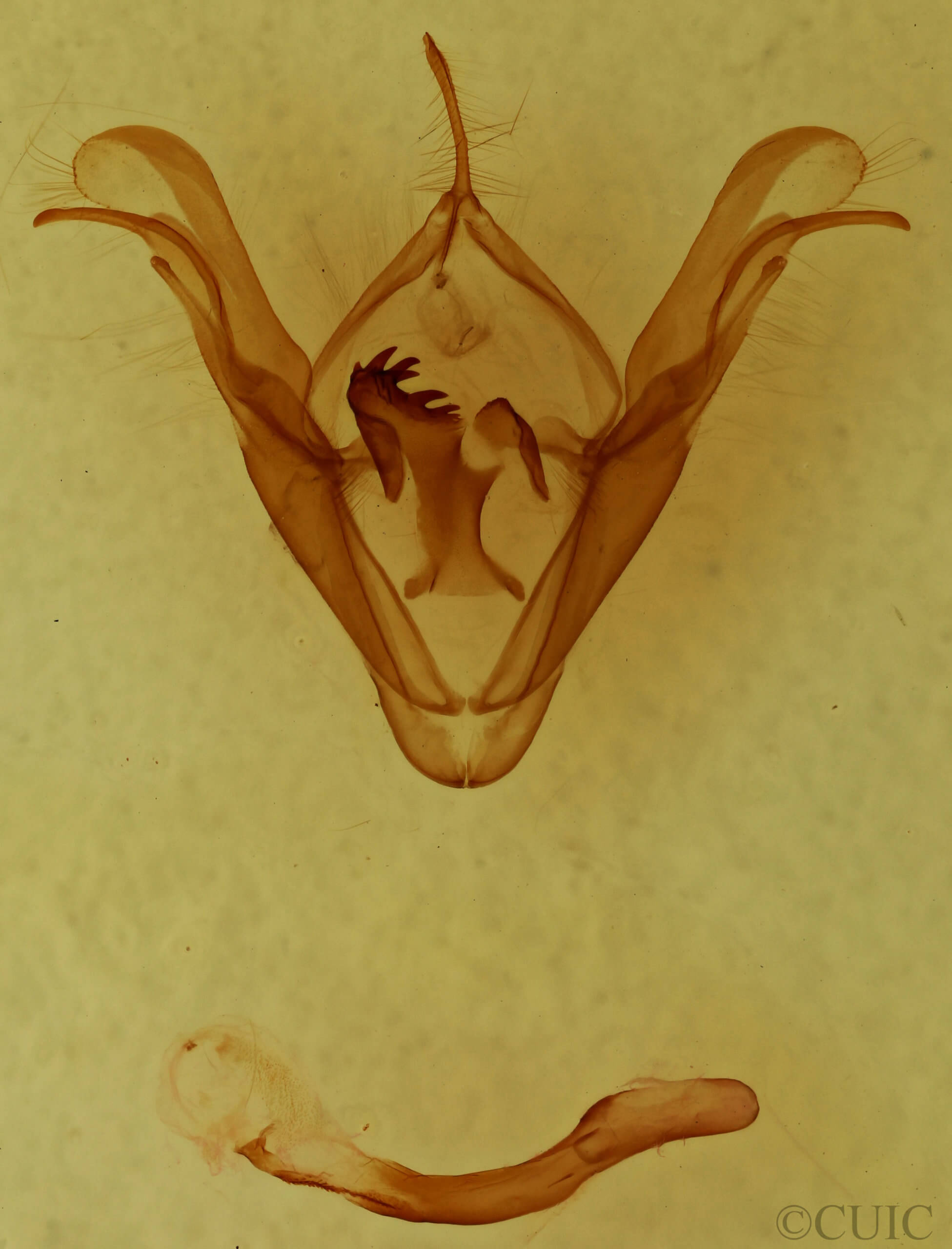 genitalia view of adult Celiptera frustulum
