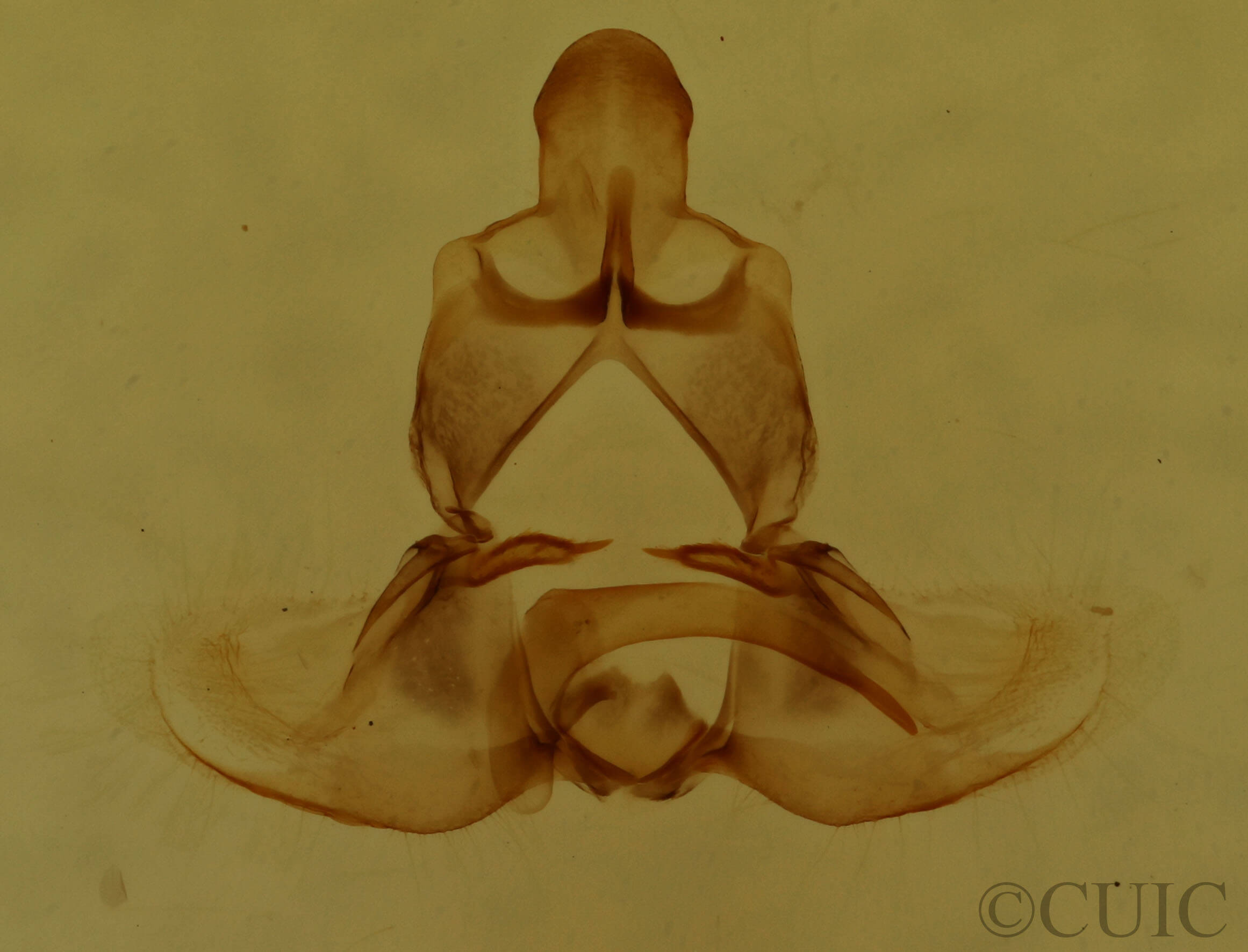 genitalia view of adult Clepsis clemensiana