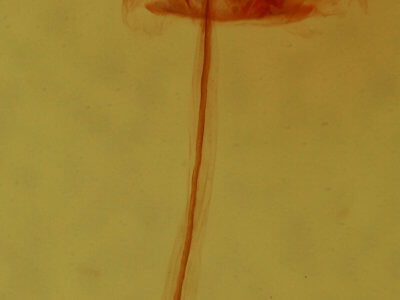 genitalia view of adult Clepsis clemensiana