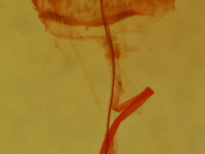 genitalia view of adult Clepsis clemensiana