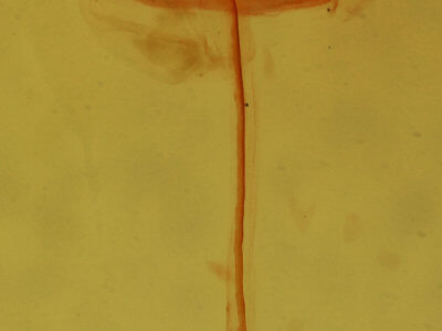 genitalia view of adult Clepsis clemensiana