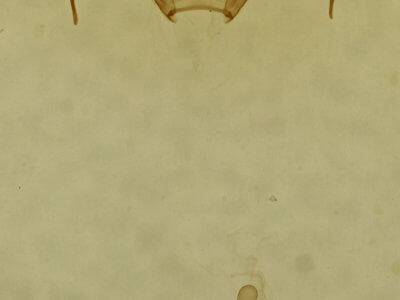 genitalia view of adult Cyclophora pendulinaria
