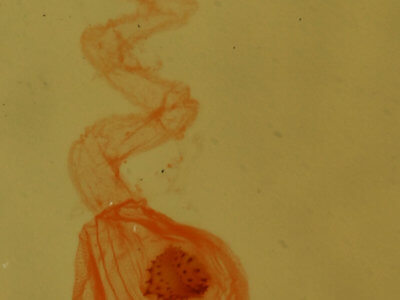 genitalia view of adult Nites ostryella