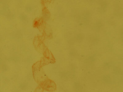 genitalia view of adult Nites ostryella