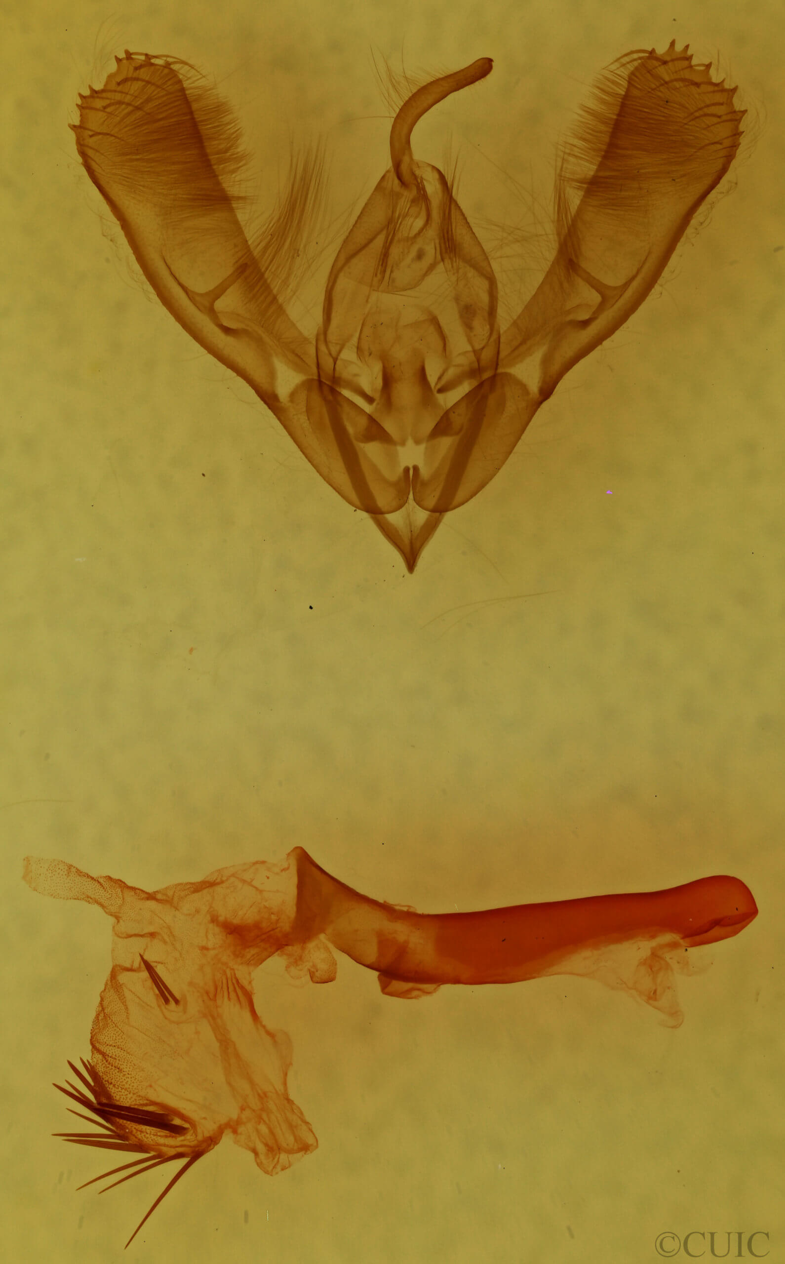 genitalia view of adult Diplocycla