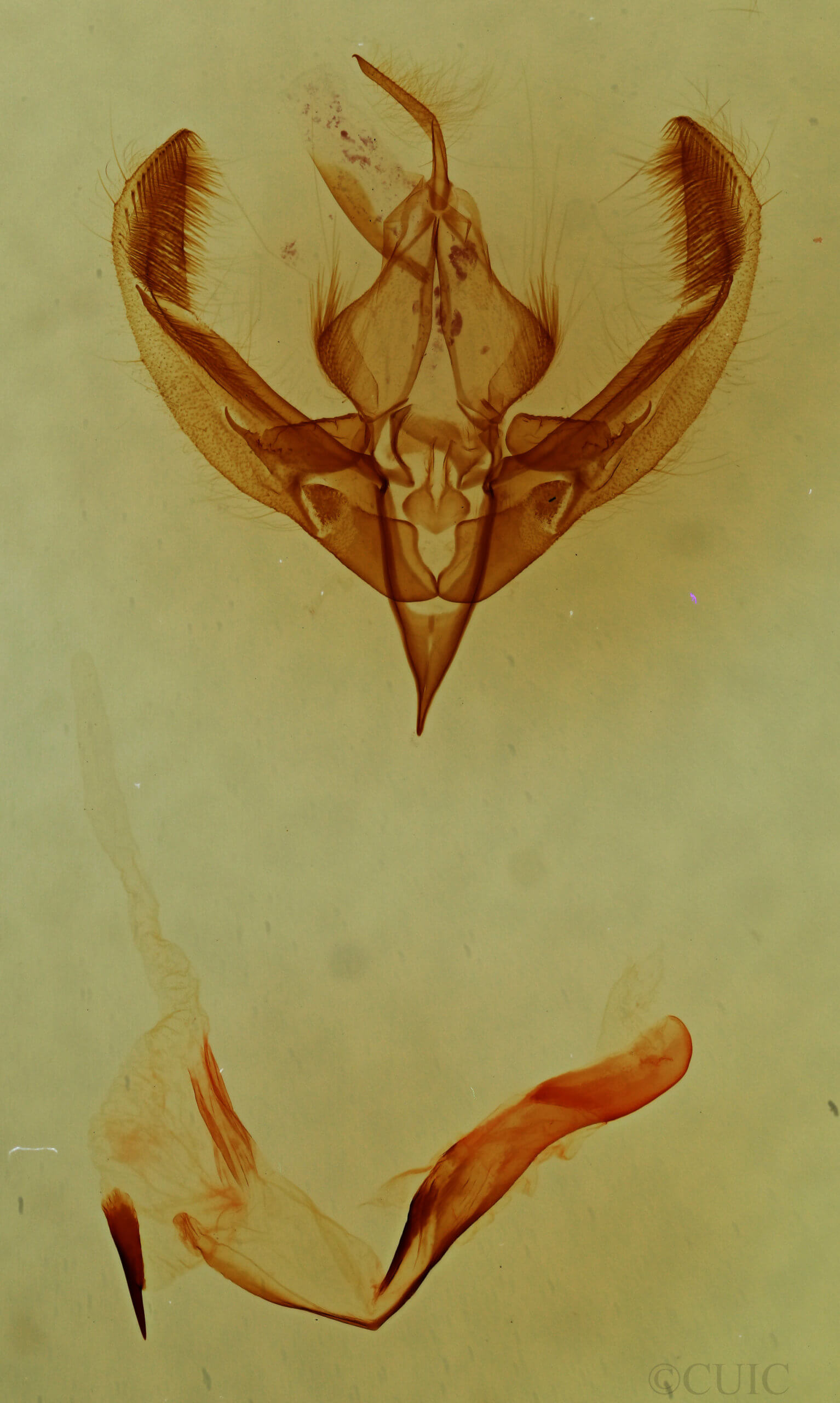 genitalia view of adult Bryolymnia semifascia