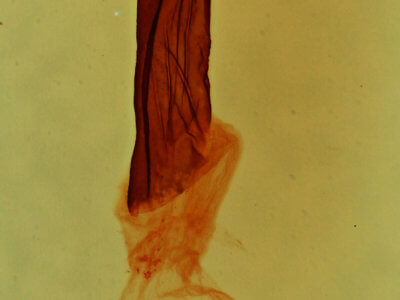 genitalia view of adult Bryolymnia semifascia