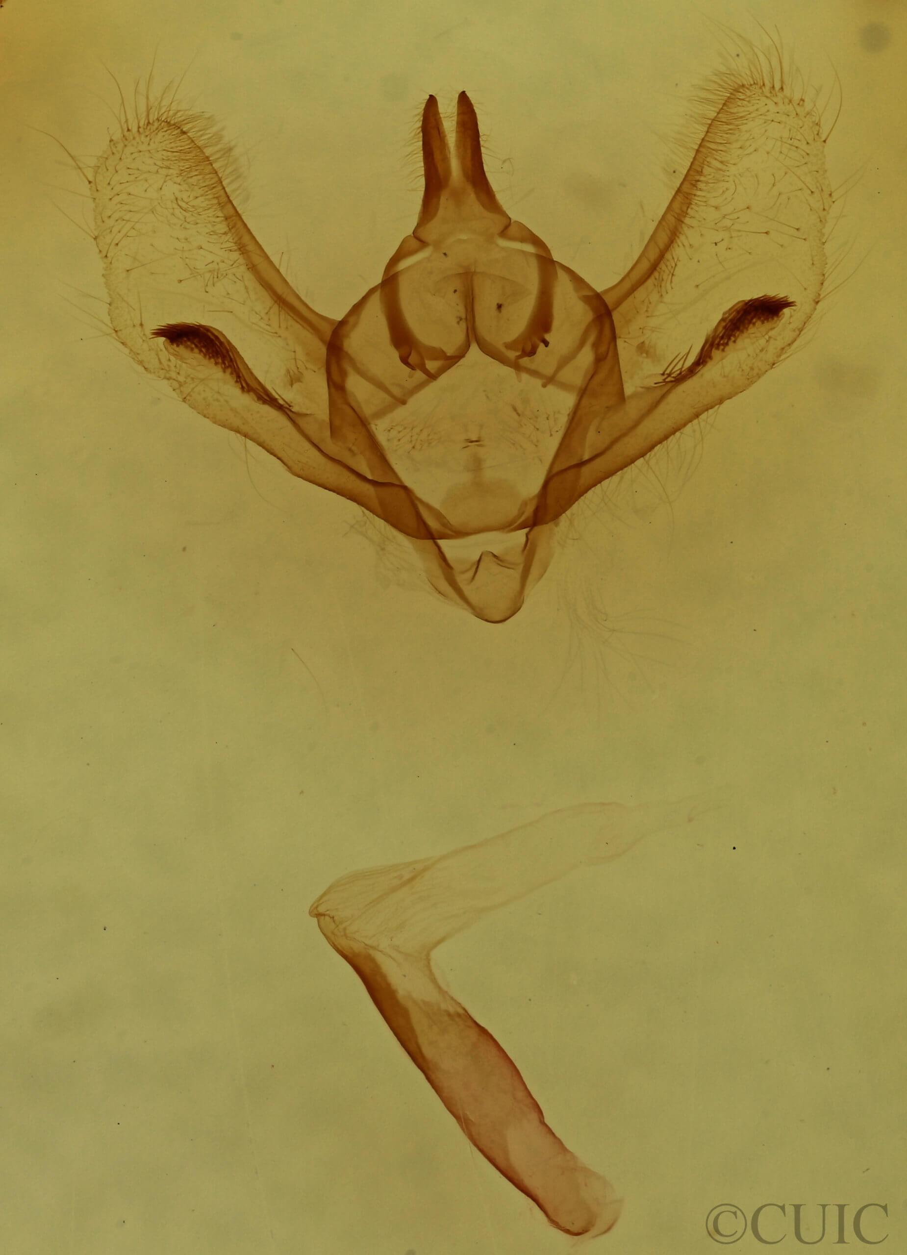 genitalia view of adult Epimecis hortaria