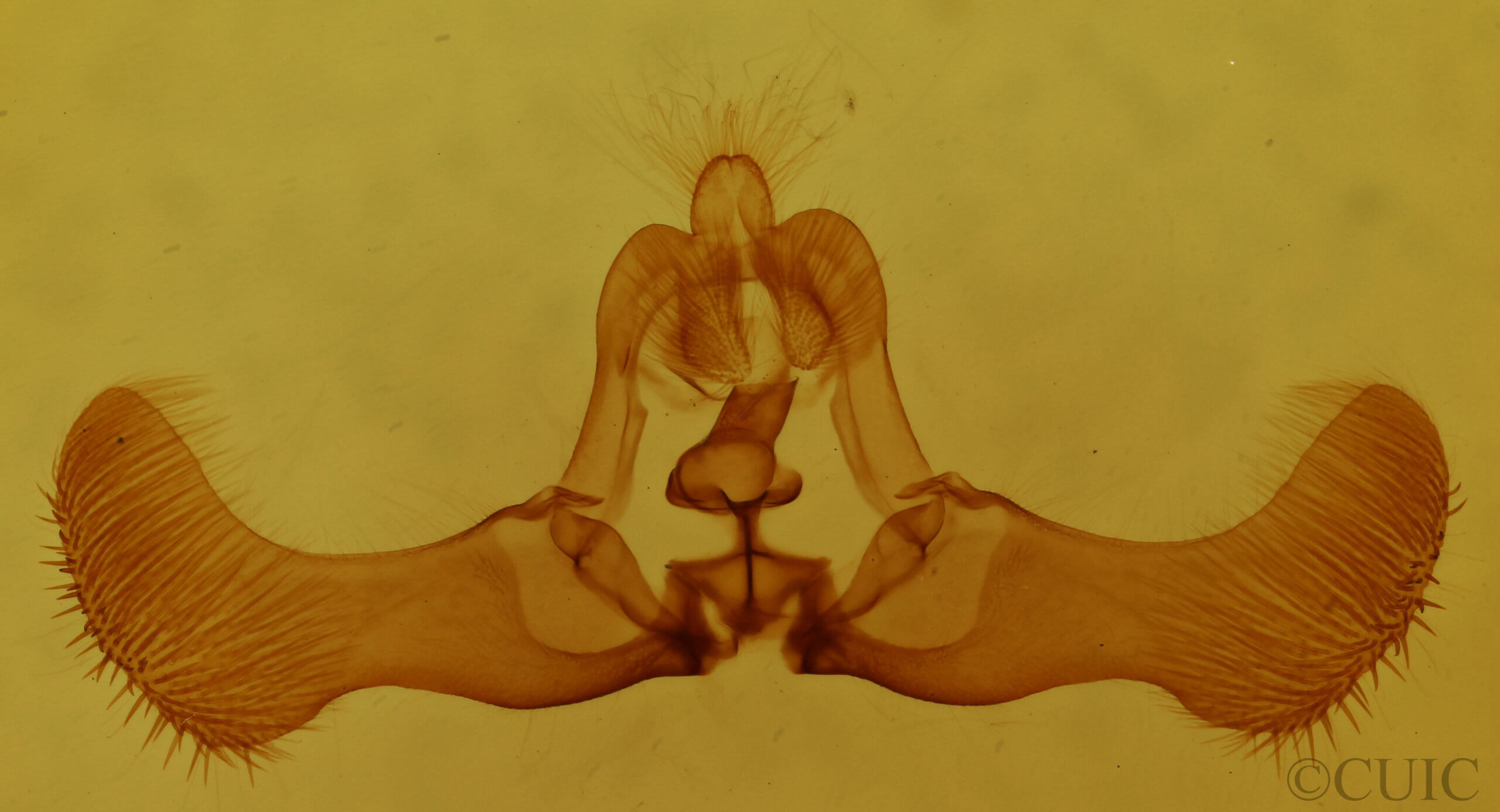 genitalia view of adult Eucosma optimana
