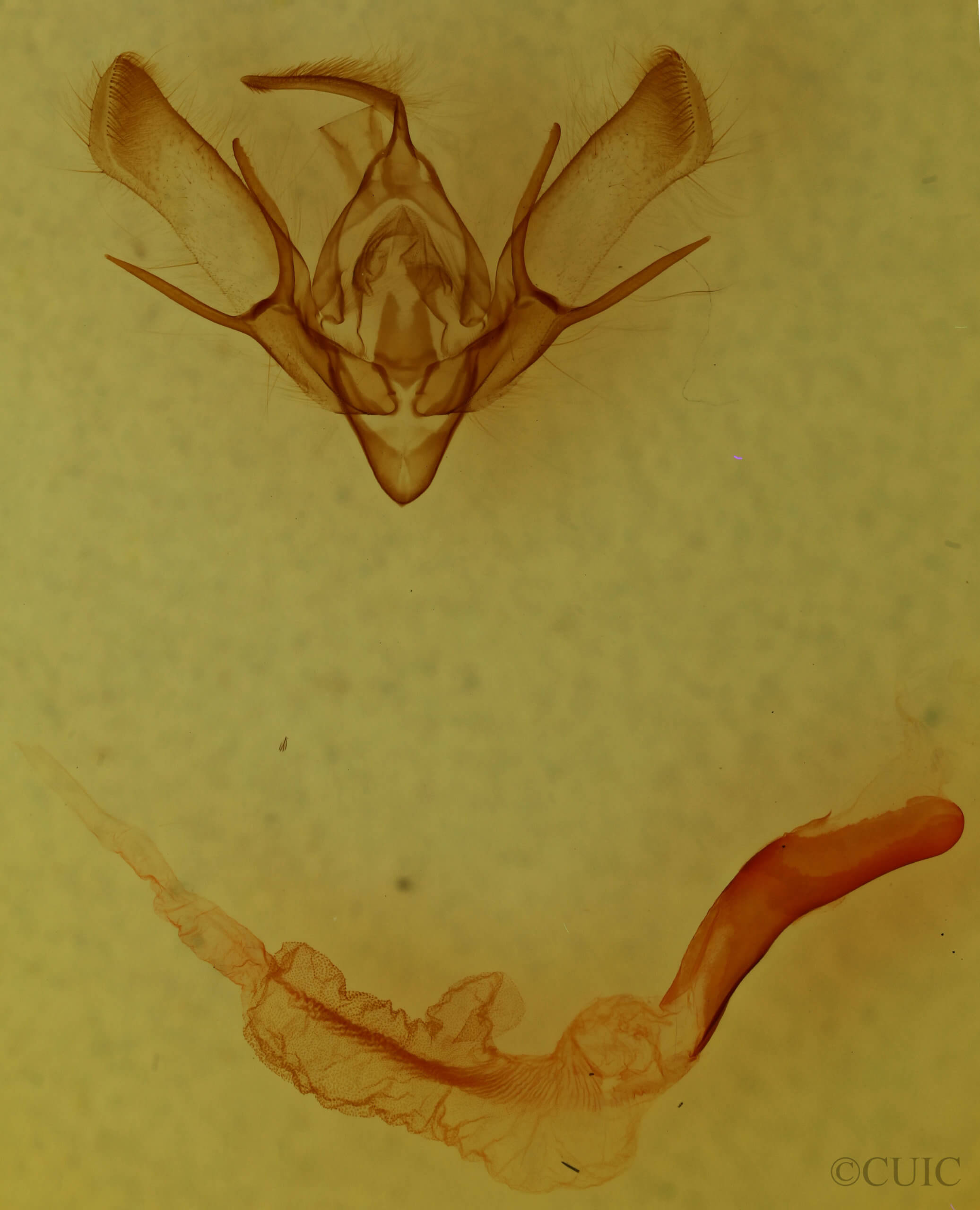 genitalia view of adult Euxoa aequalis