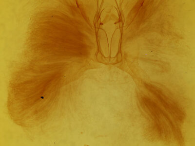 genitalia view of adult Sparganothis xanthoides