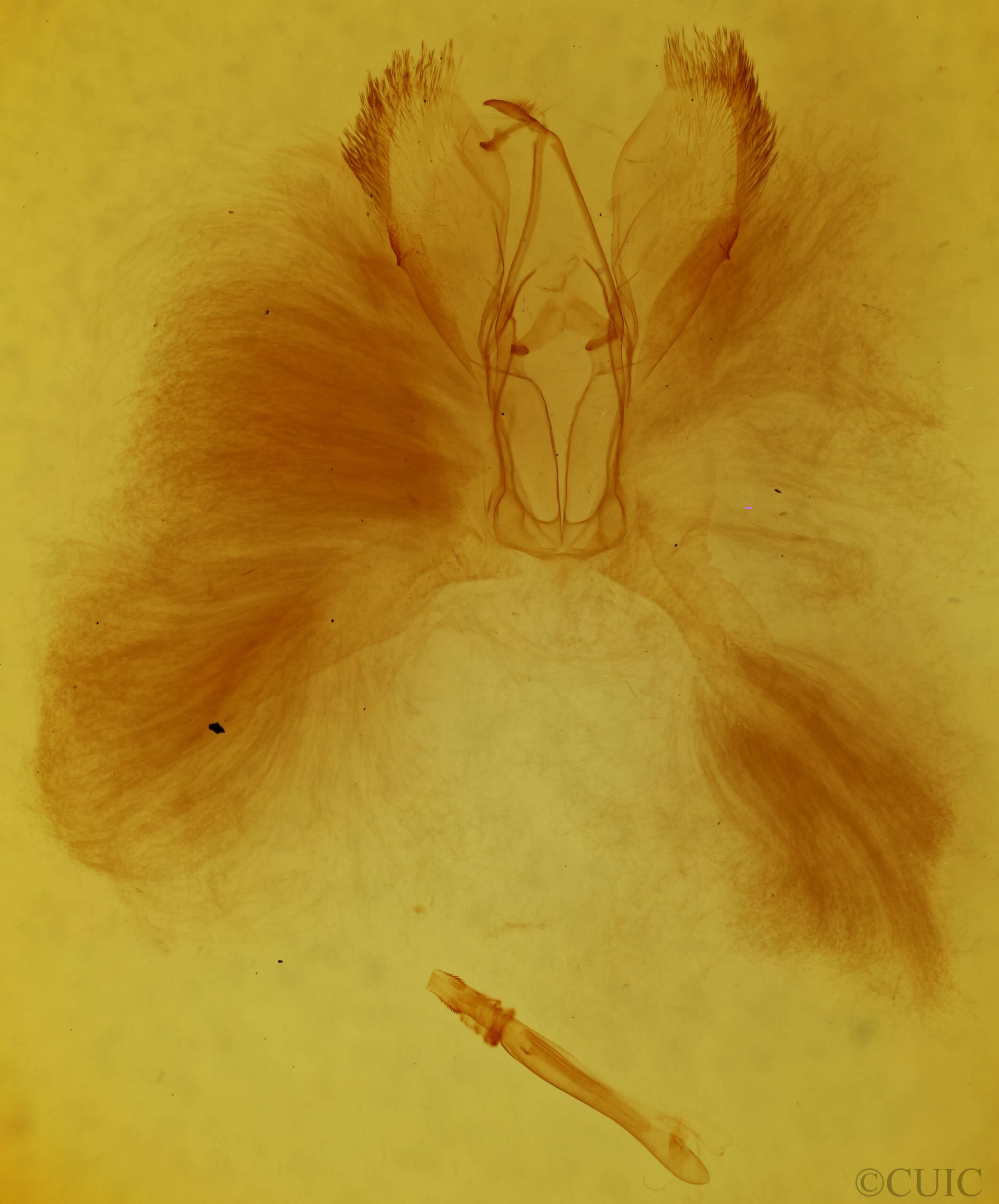 genitalia view of adult Sparganothis xanthoides
