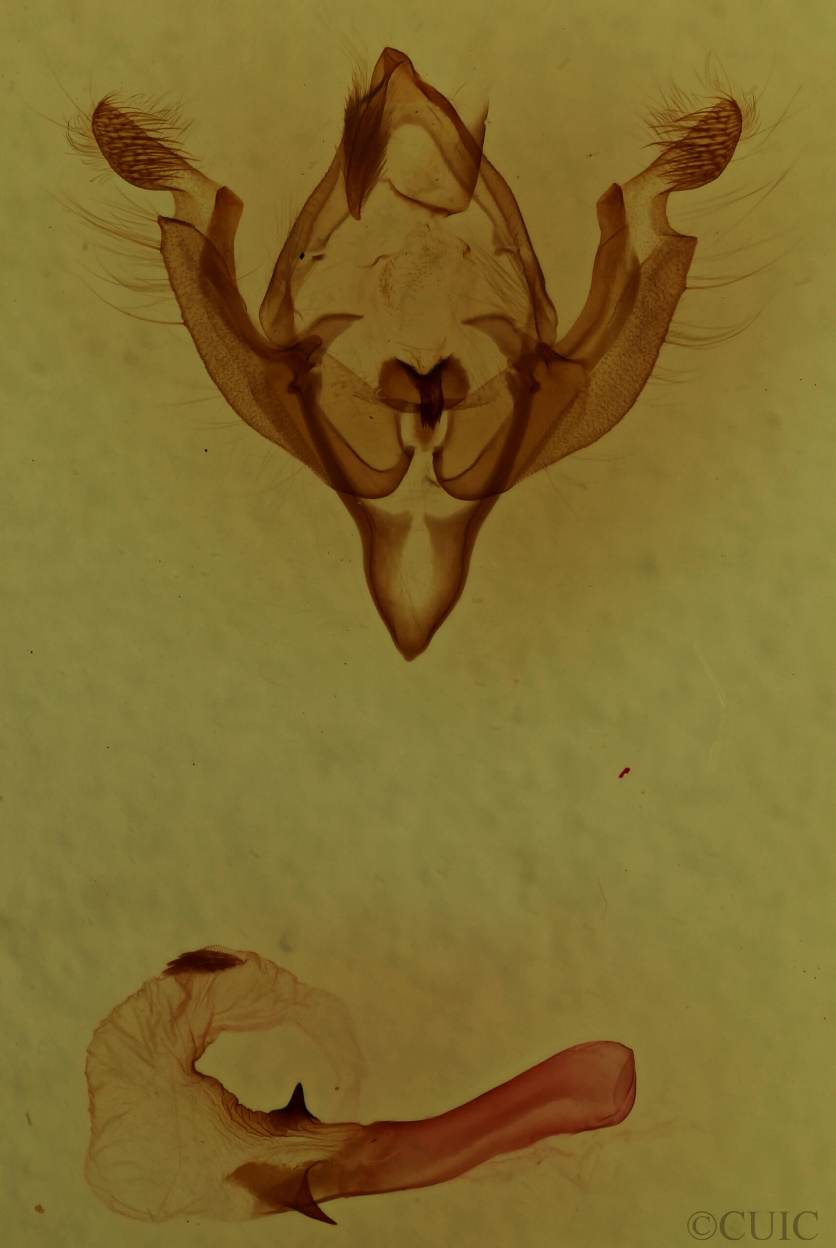 genitalia view of adult Hadena capsularis