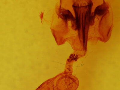 genitalia view of adult Hemicephalis