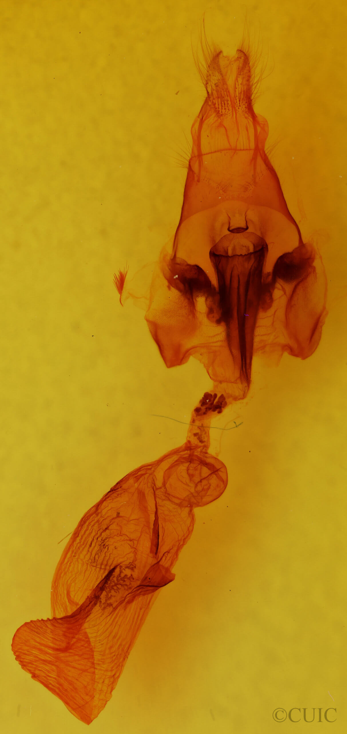 genitalia view of adult Hemicephalis
