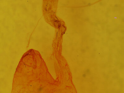 genitalia view of adult Hemicephalis alesa