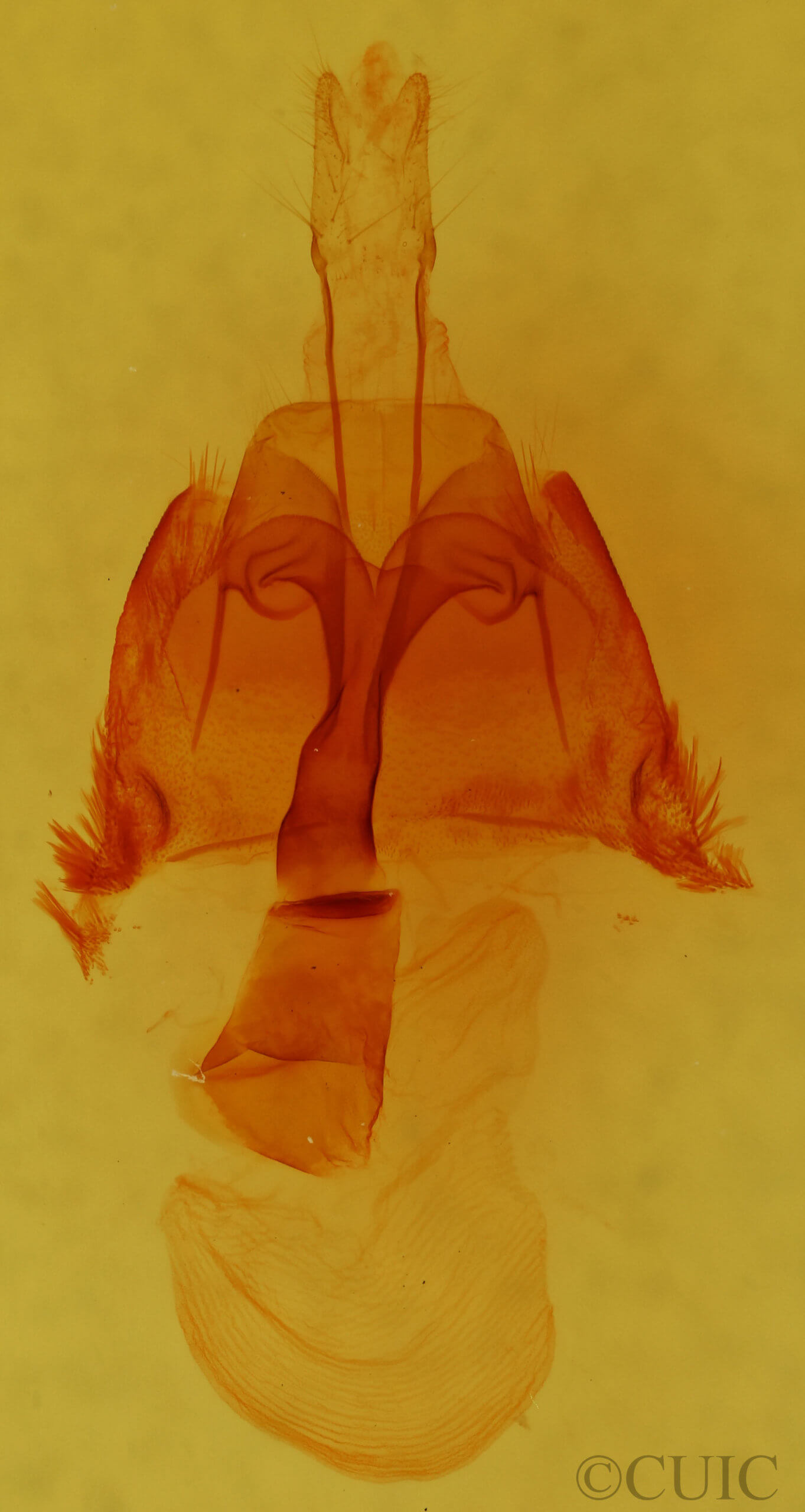genitalia view of adult Homorthodes lindseyi
