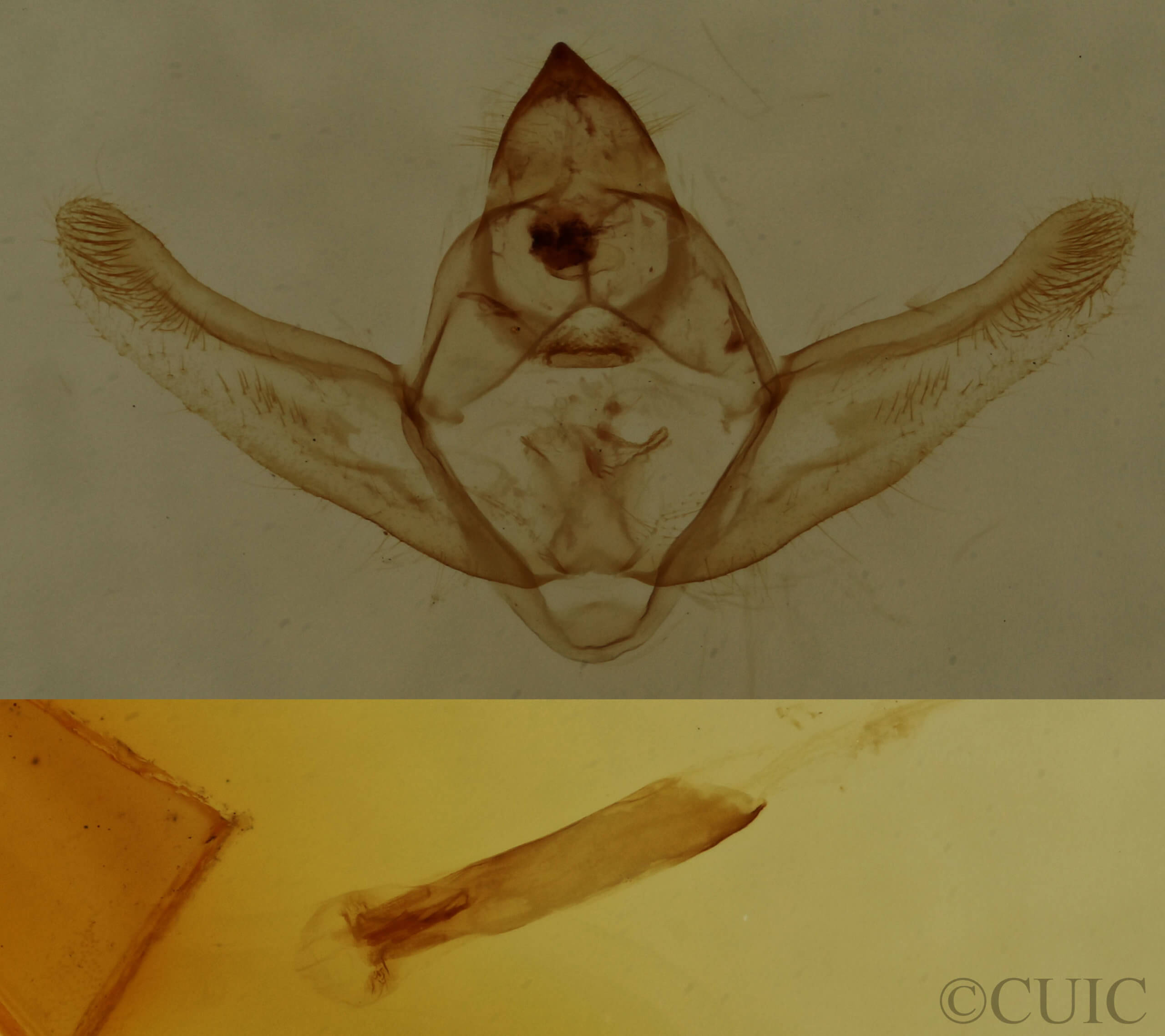 genitalia view of adult Hypagyrtis unipunctata