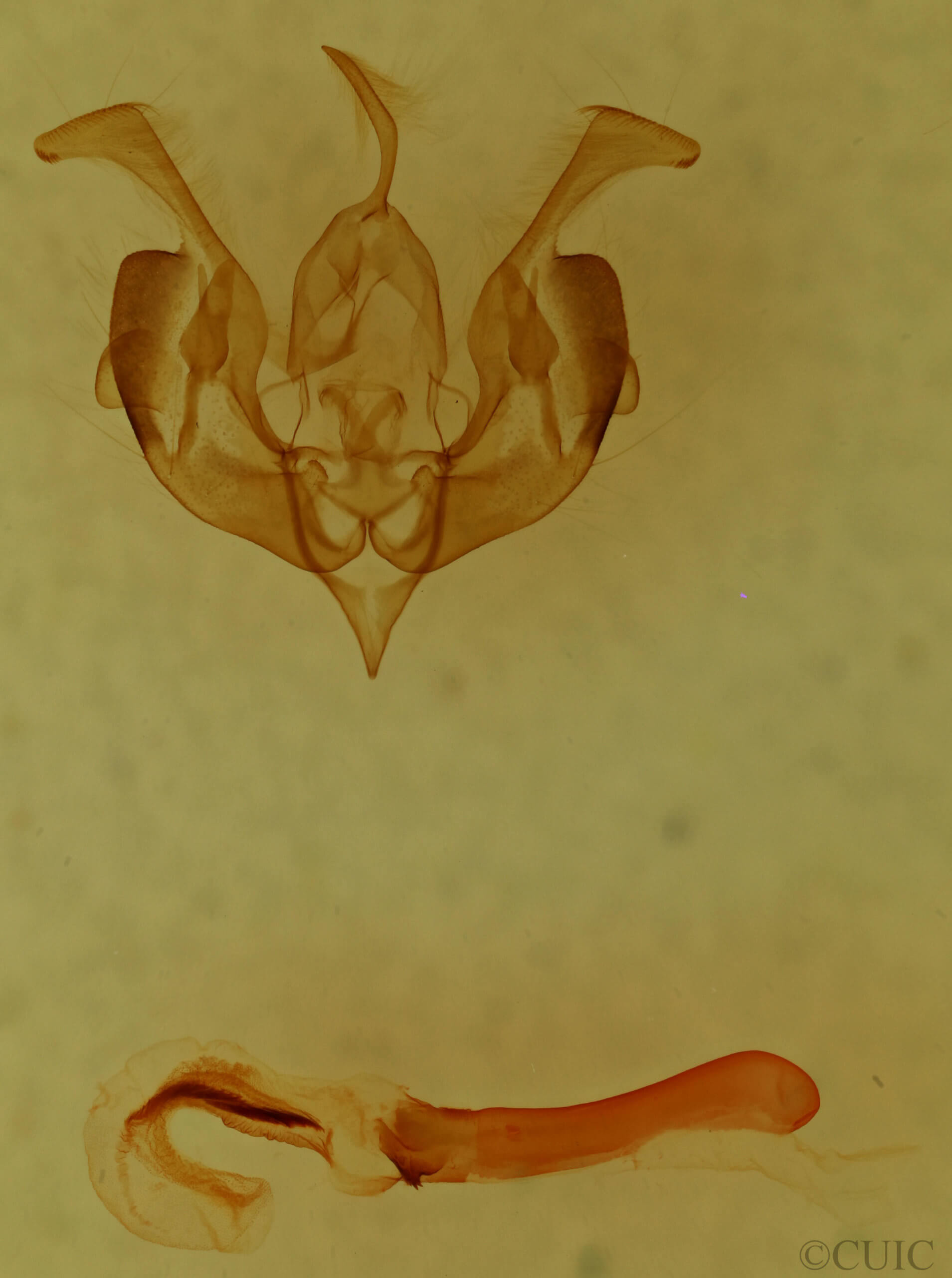 genitalia view of adult Lacinipolia strigicollis