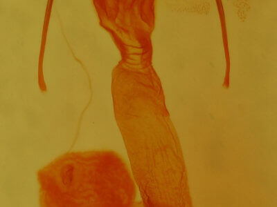 genitalia view of adult Lacinipolia strigicollis