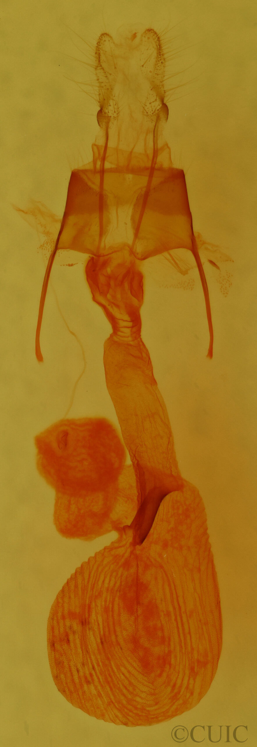 genitalia view of adult Lacinipolia strigicollis