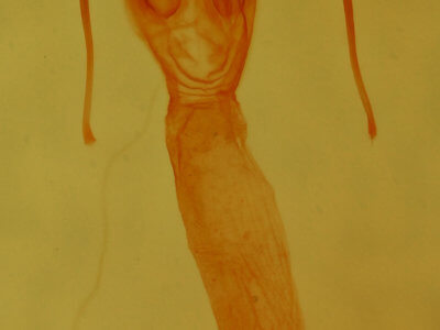 genitalia view of adult Lacinipolia strigicollis