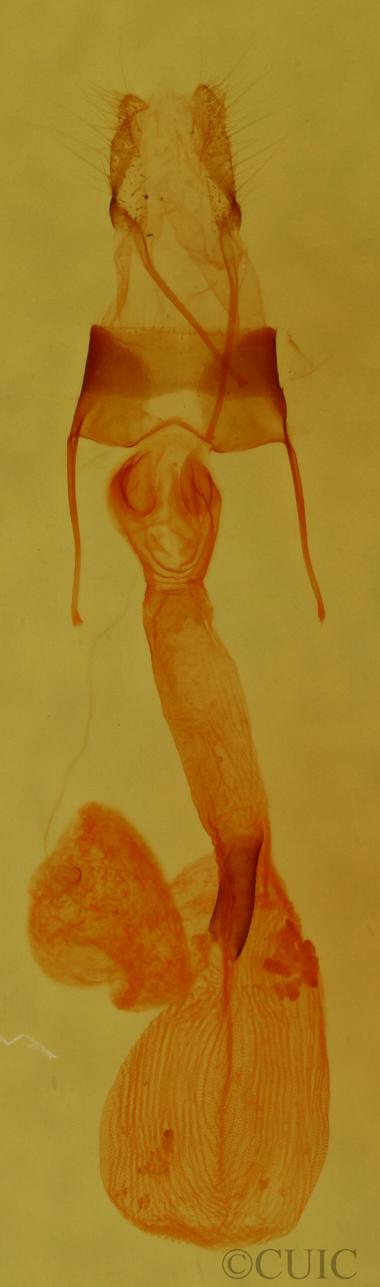 genitalia view of adult Lacinipolia strigicollis