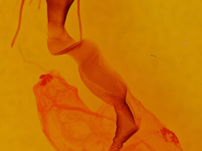 genitalia view of adult Lacinipolia palilis