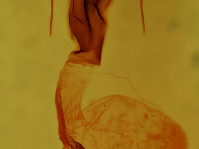 genitalia view of adult Lacinipolia quadrilineata