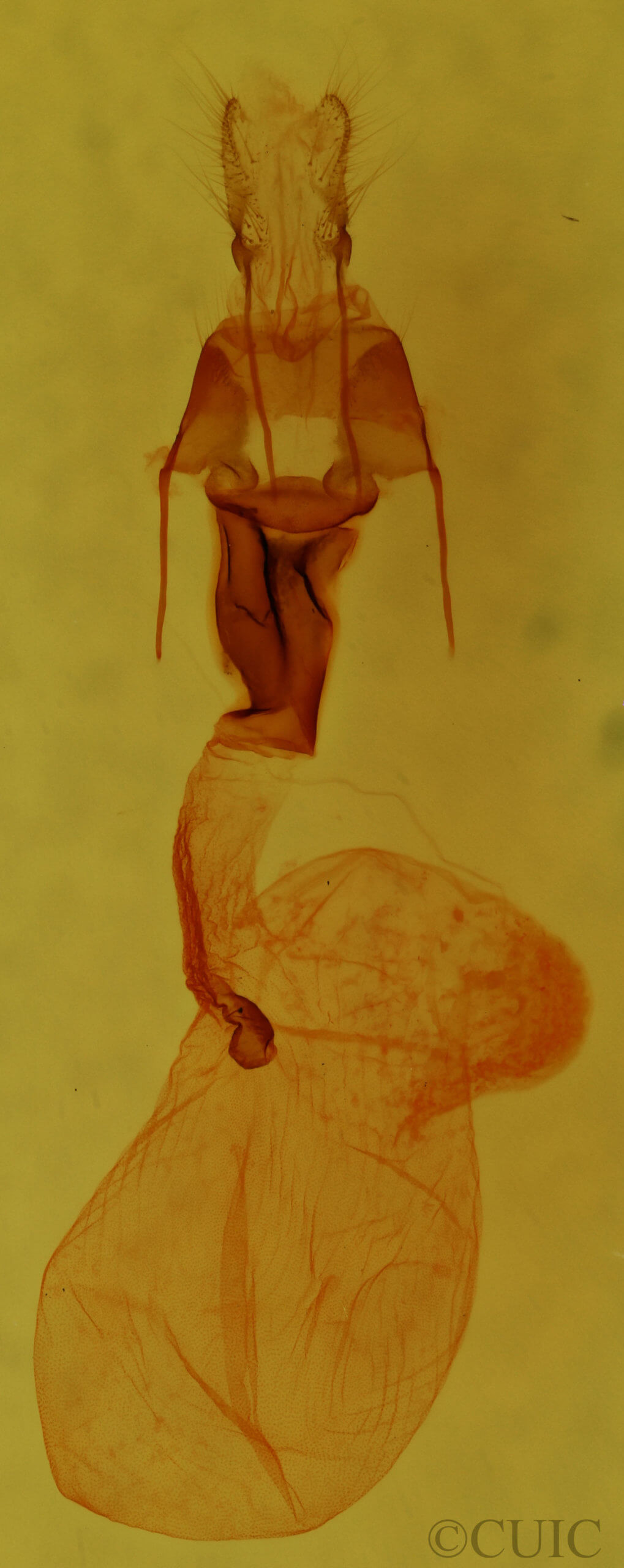 genitalia view of adult Lacinipolia quadrilineata