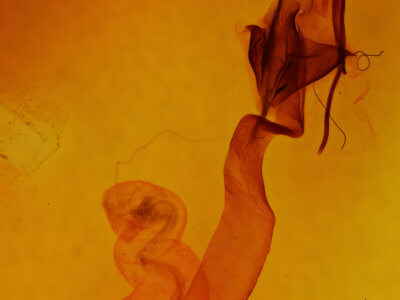 genitalia view of adult Lacinipolia vicina