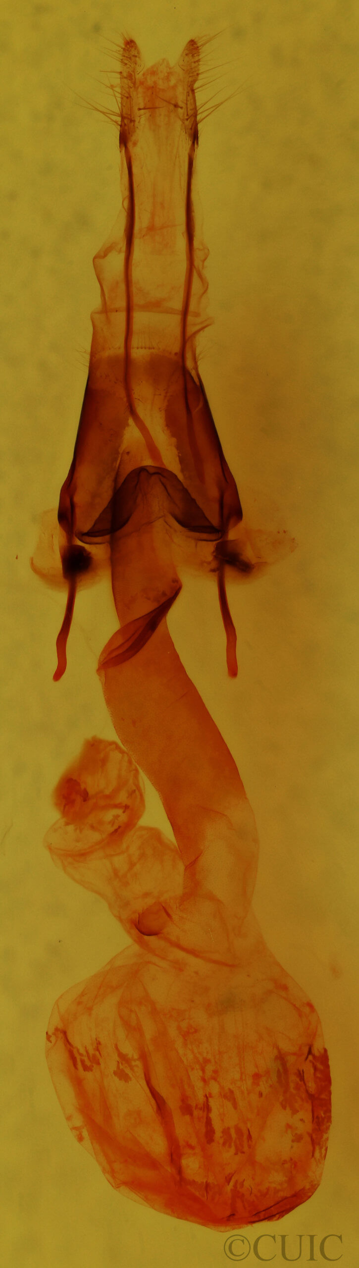 genitalia view of adult Lacinipola sareta