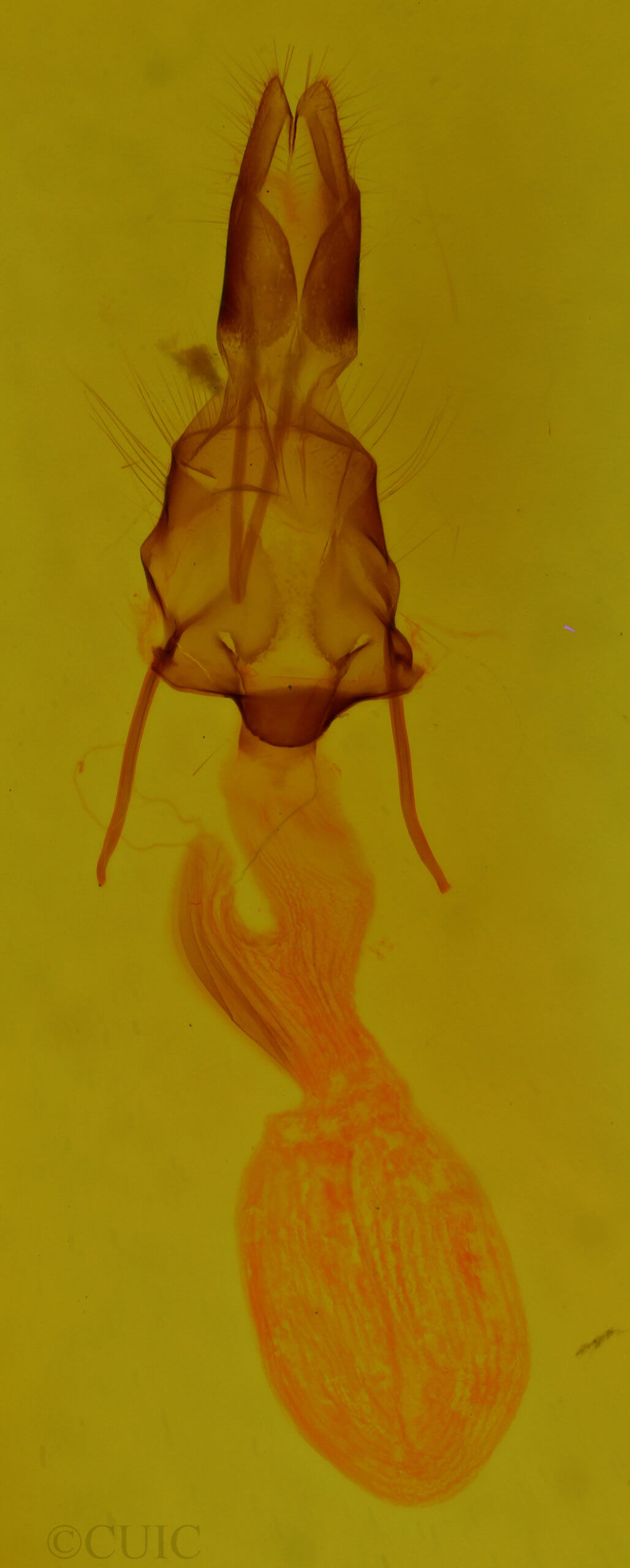genitalia view of adult Leucania celebensis