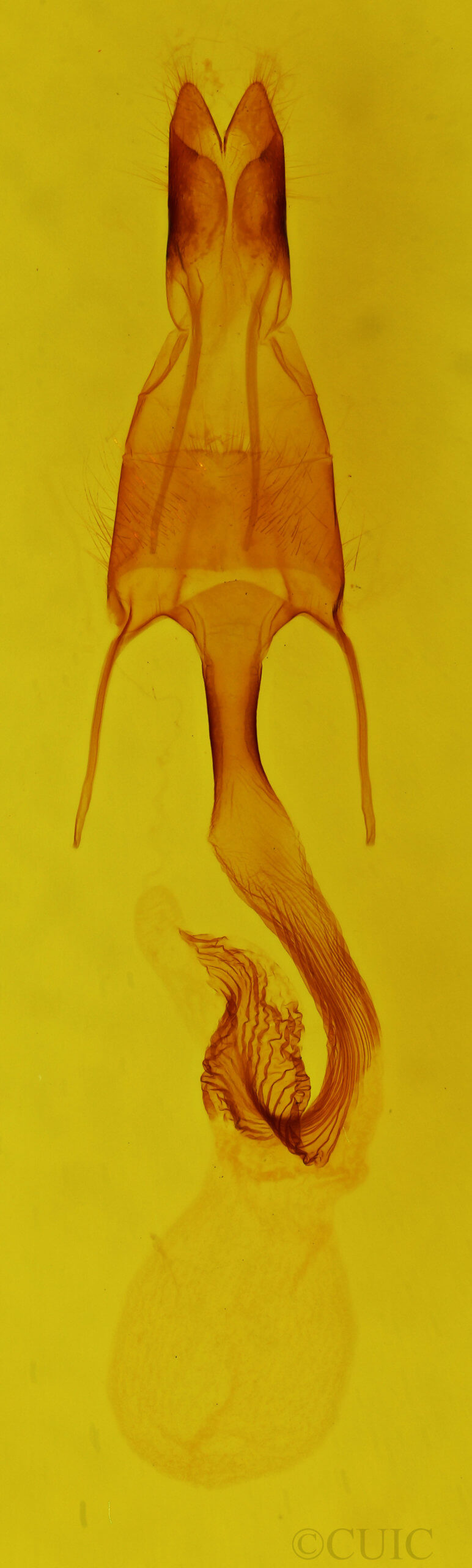 genitalia view of adult Leucania yu