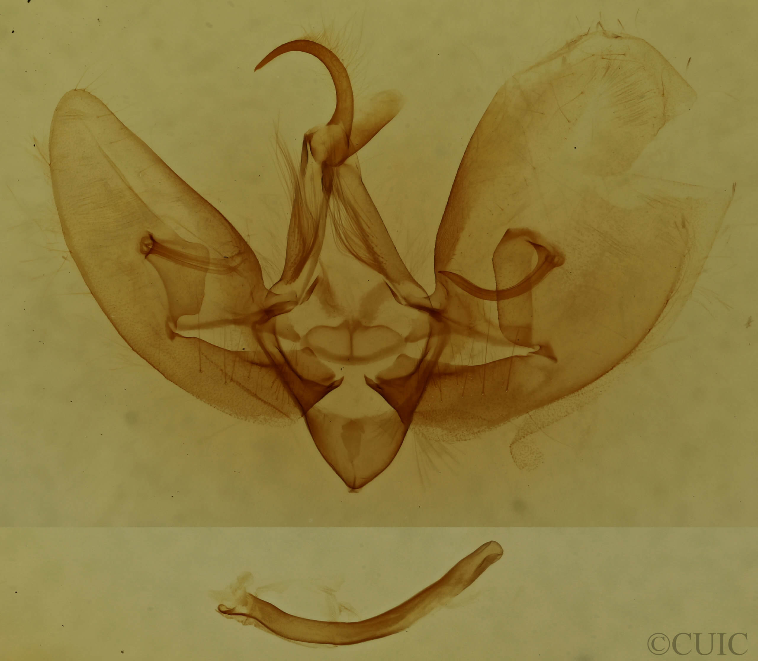 genitalia view of adult Leuconycta diphteroides