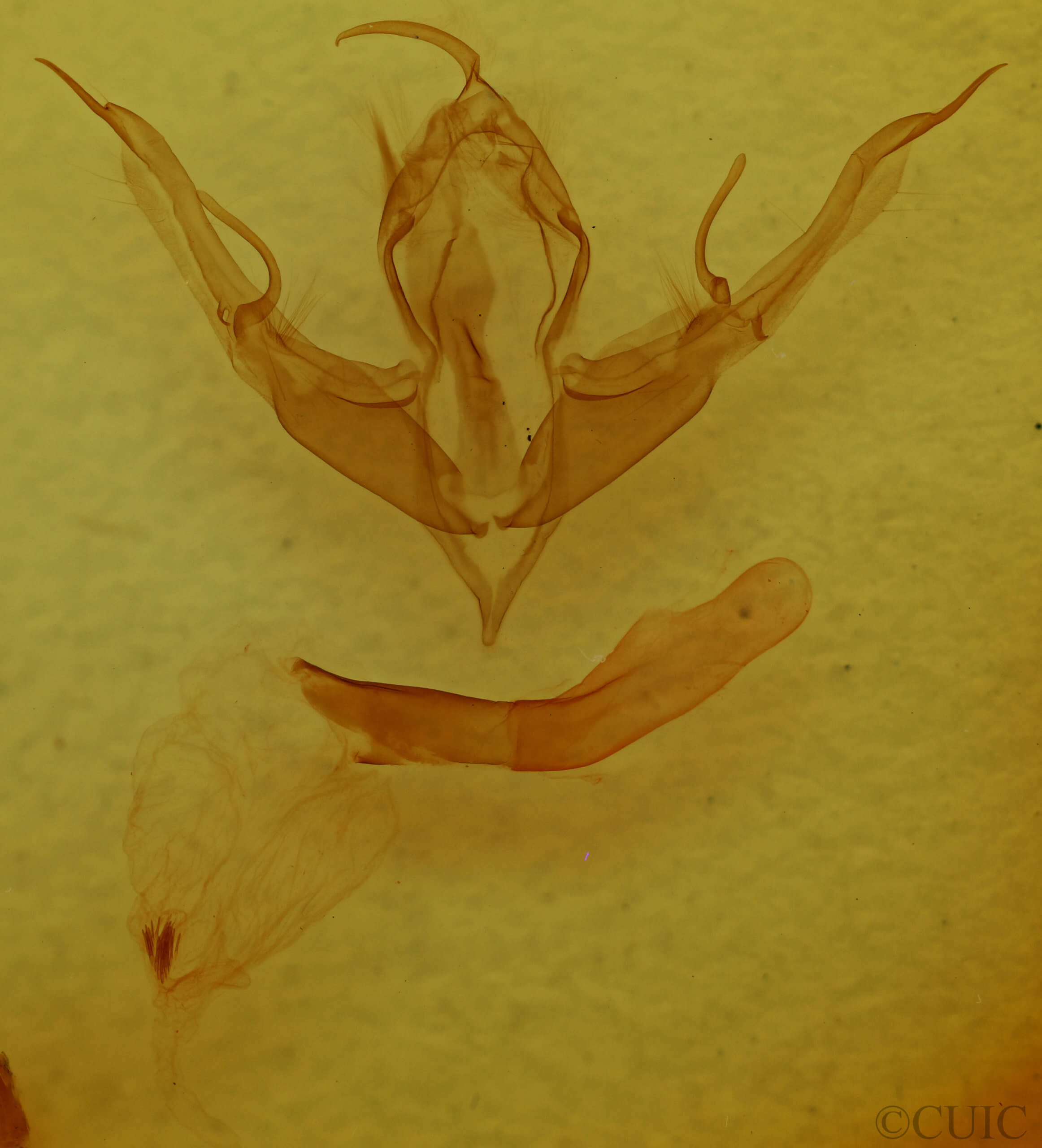 genitalia view of adult Lithophane tepida