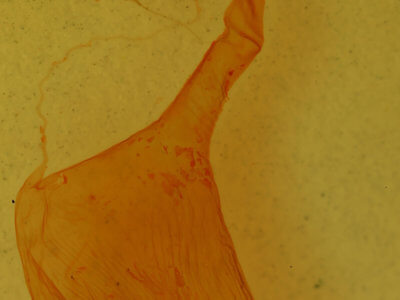 genitalia view of adult Litoprosopus futilis
