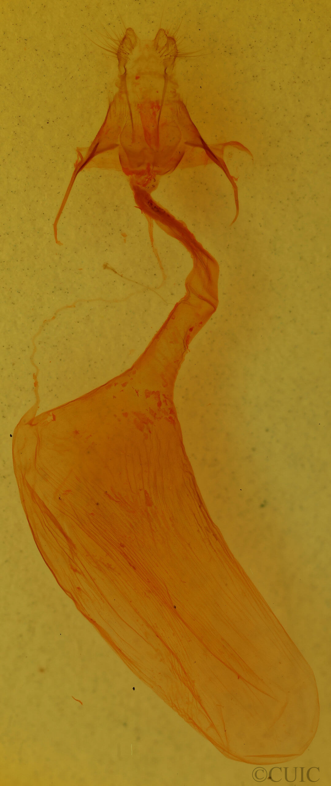 genitalia view of adult Litoprosopus futilis
