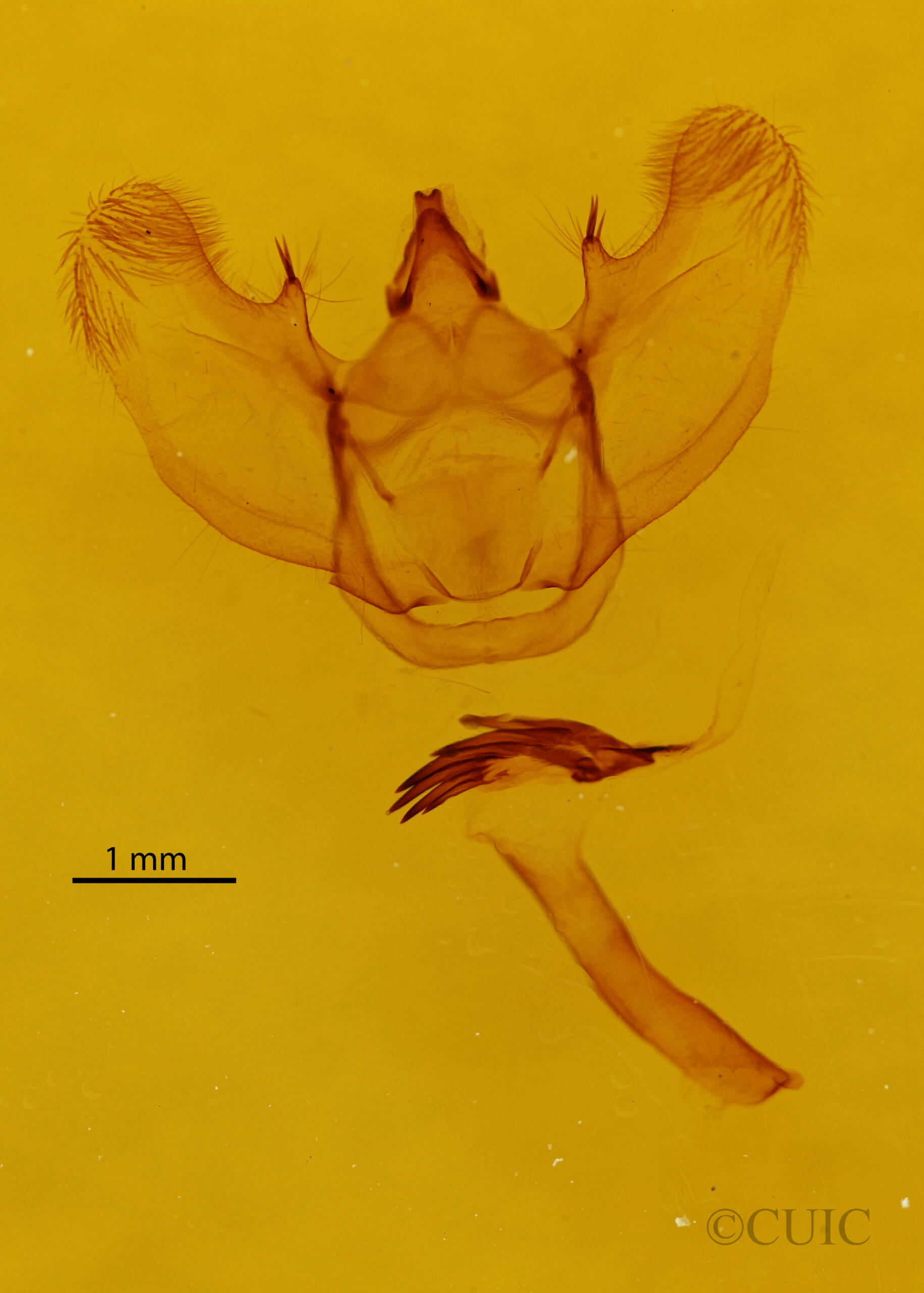 genitalia view of adult Lytrosis sinuosa